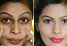 यो गोप्य विधिबाट बनाउनुहोस घामले पुरै डढेको छालालाई सेतो र चम्किलो