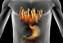 ग्यास्ट्रिकको समस्या हुनेले के खाने, के नखाने ?