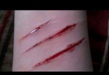 आफ्नै शरीर काटेर अर्कोको नाममा उजुरी दिने पक्राउ