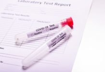 कोभिड–१९ परीक्षणको नक्कली रिर्पोेट बनाइदिने कर्मचारीमाथि छानबिन सुरु