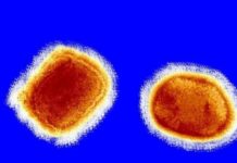 चीनमा उपचारै नभएकाे हेनिपाभाइरस फेला