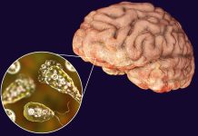 ‘ब्रेन इटिङ अमीबा’को संक्रमणबाट कम्तीमा १८ जनाको मृत्यु