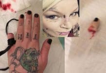 औंला काटेर खुशी बाँडे युवतीले