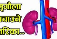 मिर्गौला हेरचाह यसरी गर्नुहोस्