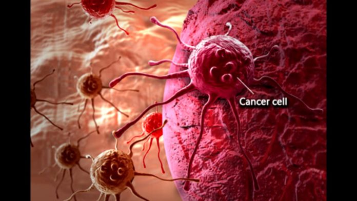 cancer