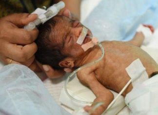 58,000 children die every year in India due to antibiotic resistance : report