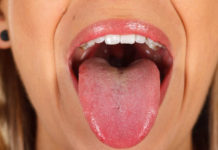 सम्बन्ध विच्छेद पश्चात श्रीमतीको जिब्रो काटे