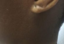 आईफोन चार्जरले छोइएपछि महिला घाइते