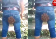 मानिसको मलद्वारमा माहुरीको गोलो