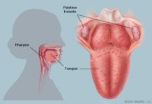 टन्सिलबाट पीडित हुनुहुन्छ ? यी हुन् घरायसी औषधि