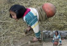 दुइटै खुट्टा नभएकी बच्ची बनिन् च्याम्पियन
