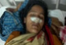 पतिलाई धोका दिएपछि प्रेमीको गाउँलेले नाक काटिदिए