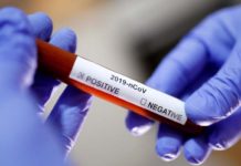 क्वारेन्टाइनमा रहेका १ सय ६४ जनाको रयापिड टेस्ट, स्वाबबाट १५७ को परीक्षण