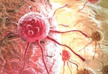 क्यान्सरको गुणस्तरीय उपचार