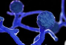 यी व्यक्तिमा कालो ढुसीकाे जोखिम?