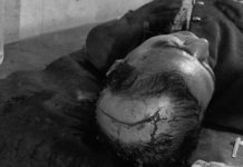 जनमत र जसपा पार्टीका कार्यकर्ताबीच झडप