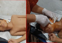 एक बालिकालाई चितुवाले आक्रमण