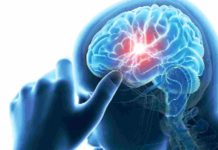 विश्व पक्षघात दिवसः विश्वमा बर्सेनि एक करोड ३० लाखमा पक्षाघात