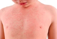 नेपालगञ्ज उपमहानगरपालिकाले दुई दिन विद्यालय बन्द