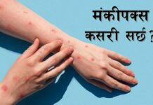 मंकीपक्सबाट बच्ने तरिका