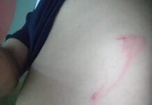 रोमानियामा नेपाली कामदारलाई यातना दिएर कामबाट निकाल्ने प्रवृत्ति बढ्दाे