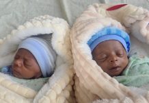जुम्ल्याहा शिशुको २ महिना लामो सघन उपचारपछि ज्यान बचाउन सफल